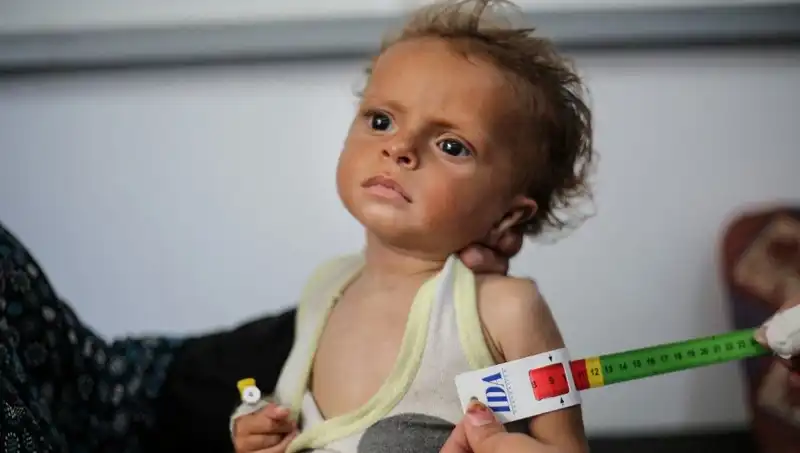 İngiltere, Gazze'deki 300 Çocuğa Yeni Bir Gelecek Sunuyor