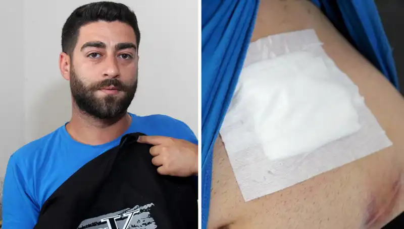 Karnındaki Ağrının Nedeni Röntgende Ortaya Çıktı: İşte Şok Edici Sonuçlar