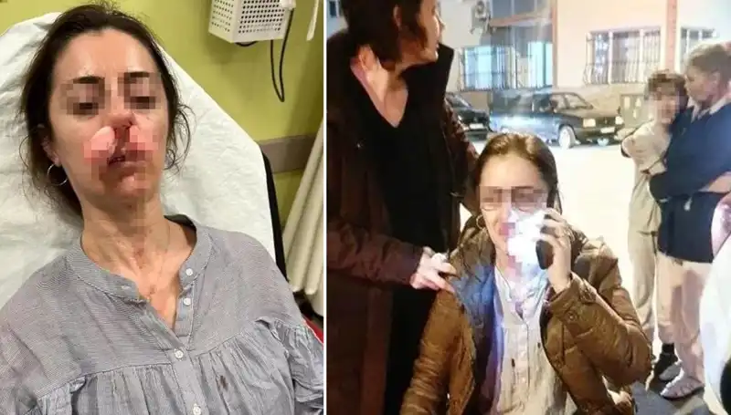 Otomobil Kapısı Silah Sayıldı: Eşinin Sevgilisini Hedef Alan Adamın Şok Edici Olayı
