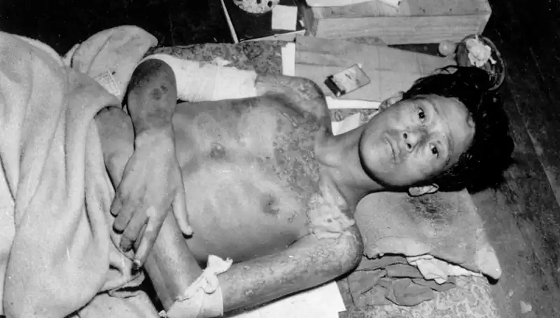 80 Yıl Sonra Nagasaki'den Korkutan Uyarı: Nükleer Felaket Geliyor!